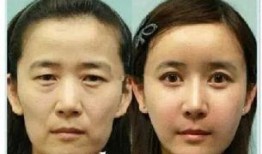 爆料整容诈骗案例视频,视频揭露惊人内幕